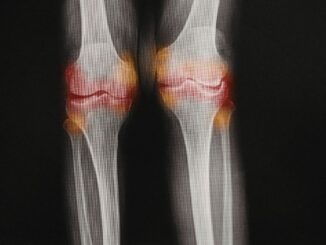 ד"ר אלעד לאור - כאבי מפרקים