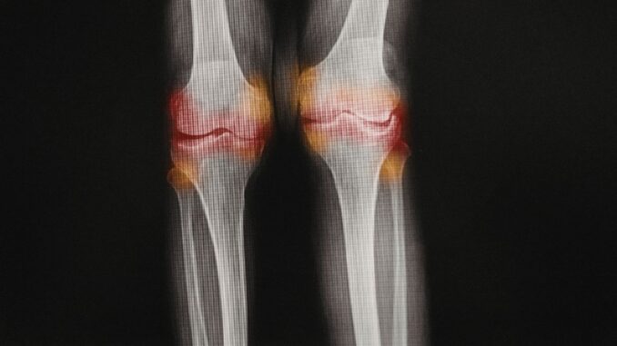 ד"ר אלעד לאור - כאבי מפרקים